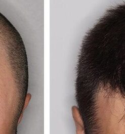 Biotin and Rosemary Shampoo for Thinning Hair - Sulfate Free Biotin Shampoo for Men with Hair Thickening Essential Oils - Deep Cleansing Volumizing Shampoo for Thin Hair with Zinc and Tea Tree Oil 32 5197 aSIenL