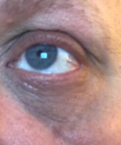 InstaNatural Hyaluronic Acid Face Serum, Brightens, Hydrates, Reduces the Look of Fine Lines and Wrinkles, with Vitamin C, Jojoba Oil, and Aloe Vera, 2 Fl Oz Hyaluronic Acid Serum 31 519ngUfSykL