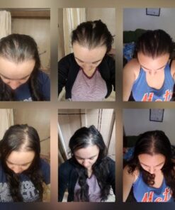 Amazing Formulas Biotin 10000mcg 200 Veggie Capsules Supplement | Non GMO | Gluten Free | Made in USA | Suitable for Vegetarians 200 Count (Pack of 1) 29 51BoLYRqRL