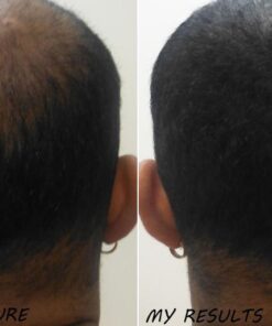 Newopure: Natural Hair Growth Vitamins, Repairs Hair Follicles, Stops Hair Loss, Blocks DHT, Stimulates New Hair Growth, Promotes Thicker, Fuller and Faster Growing Hair. Men & Women (30 Day Supply) 30 51DNnKLCp2L