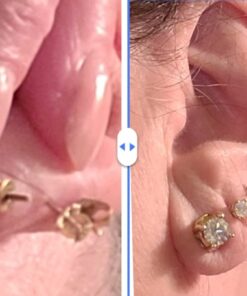 Chrysmela Catch Yellow Gold most secure high tech earring lock earring back replacement for all types of earring posts auto adjustable auto locking hypoallergenic patented in 5 countries 26 51DRMtQ7rWL