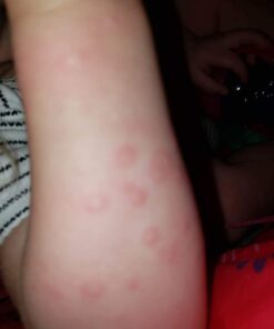 Aveeno Soothing Bath Soak for Eczema, Natural Colloidal Oatmeal, 8 ct. 1.50 Ounce (Pack of 8) 29 51EkhLs0UL