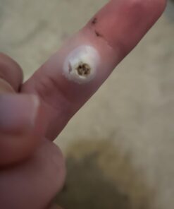 Compound W Wart Remover Maximum Strength One Step Pads, 14 Medicated Pads 14 Count (Pack of 1) 48 51FW6hm9BrL