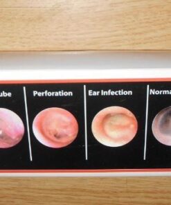 Third Generation Dr Mom Slimline Stainless LED Pocket Otoscope with Soft White Natural Hue Light Spectrum in Hard Travel Case Includes Lighted Ear Wax curettes 28 51GP364j4vL