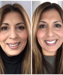 Opalescence 35% Gel Syringes Teeth Whitening - Refill Kit (4 Packs / 8 Count) Carbamide Peroxide. Made by Ultradent, in Cool Mint Flavor. Tooth Whitening Refill Syringes 5197-4 Mint 35 8 Count (Pack of 1) 23 51IgpfMT20L