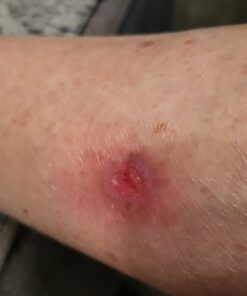 Terrasil Wound Care - 3X Faster Healing, Infection Protection Ointment for bed sores, pressure sores, diabetic wounds, ulcers, cuts, scrapes, and burns (14 gram tube) 50 51LyKnvgS7L