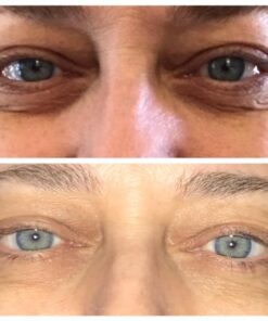 Baebody Eye Gel, Cooling Under Eye Cream For Dark Circles And Puffiness, Eye Cream Anti Aging & Hydrating, Eye Brightening Night Eye Cream 1.7 Fl Oz (Pack of 1) 41 51M 5DTxF3L