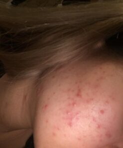 NOW Foods Supplements,Pantothenic Acid (Vitamin B-5) 500 mg,B-Complex Vitamin,250 Capsules 250 Count (Pack of 1) 30 51MSn5orjL