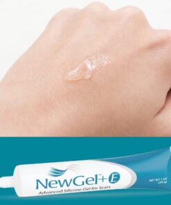 NewGel+E Advanced Silicone Scar Treatment Gel for OLD and NEW Scars w Vitamin E, for Surgery, Injury, Keloids, Burns, and Facial Blemish Scars (1 oz) 1 Ounce 21 51NV5VPiqKL