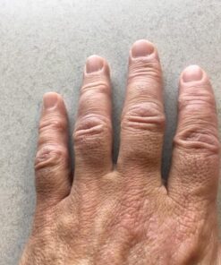 MG217 Multi Symptom Relief 2% Coal Tar Medicated Psoriasis Ointment oz Jar, 4 Oz 4 Ounce (Pack of 1) 41 51QgMOLaPUL