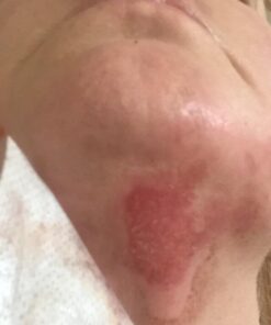 Terrasil Wound Care - 3X Faster Healing, Infection Protection Ointment for bed sores, pressure sores, diabetic wounds, ulcers, cuts, scrapes, and burns (14 gram tube) 36 51RzdxZpFRL