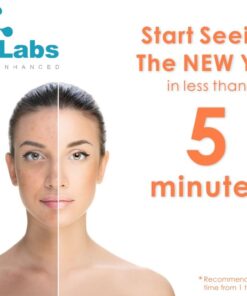 Alternative view of Glycolic Acid 30% Gel Peel with Chamomile and Green Tea Extracts - Professional Grade Chemical Face Peel for Acne Scars, Collagen Boost, Wrinkles, Fine Lines - Alpha Hydroxy Acid - 1 Bottle of 1 fl oz 1 Fl Oz (Pack of 1)