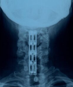 iReliev TENS + EMS Combination Unit Muscle Stimulator for Pain Relief & Arthritis & Muscle Strength - Treats Tired and Sore Muscles in Your Shoulders, Back, Ab's, Legs, Knee's and More 32 51Sx8iQNENL