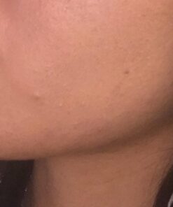 Glycolic Acid 50% Gel Peel with Chamomile and Green Tea Extracts - Professional Grade Chemical Face Peel for Acne Blemishes, Collagen Boost, Wrinkles, Fine Lines - Alpha Hydroxy Acid - 1 Bottle of 1 fl oz 44 51VrPU3q4LL