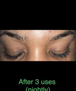 NOW Solutions, Castor Oil, 100% Pure Versatile Skin Care, Multi-Purpose Skin Softener, 16-Ounce 16 Fl Oz (Pack of 1) Standard Packaging 33 51YPsl9ov6L