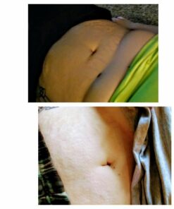 Lipogel Caffeine Slimming & Slendering System Cream 8 Oz. 5 51Zh7ejLvDL