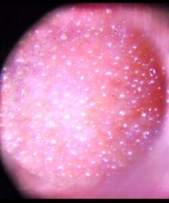 Kendal Professional Diamond Microdermabrasion Machine, Dermabrasion Facial Skin Care Equipment, Also Good for Home Use AC 110V HB-SF01 52 51ZhD2ZNJXL