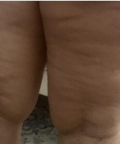 Anti Cellulite Massage Oil Infused with Collagen & Stem Cell Instant Toning Firming of Cellulite & Scar Remover for Thighs & Body Relaxing Sore Muscle Massage Therapy Cream by M3 Naturals 8 Fl Oz (Pack of 1) 36 51b2aLwlVWL