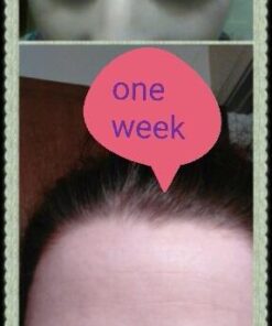 Eve Hansen Vitamin C Serum for Face | (2 OZ) Facial Serum with Natural, Organic Hyaluronic Acid, Vitamin E and Aloe Vera | Brighten, Reduce Appearance of Wrinkles, Fine Lines and Dark Spots 2 Fl Oz (Pack of 1) 35 51cwvOwtWnL