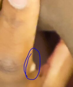 Dr. Scholl's Dual Action Freeze Away WART Remover, 8 Applications // Freeze Therapy + Powerful Fast Acting Salicylic Liquid to Remove Common and Plantar Warts, 0.33 Fl Oz, 1 Count 38 51dCKLBExXL