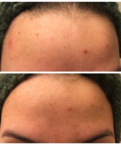 Yes To Tomatoes Bar Soap Activated Charcoal with Tomato Extracts and Sunflower Seed Oil Face, Body Soap for Men, Women and Teens No Paraben, 7 Ounce Bar 7 Ounce (Pack of 1) 30 51eOXbiMMkL