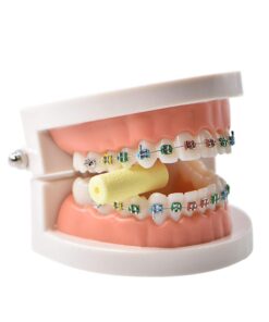 Angzhili 3 Pcs/Box Aligner Chewy,Silicone Orthodontic Chewers for Aligner Trays Seater,Chew Sticks with Storage Case(Yellow) Yellow 12 51g213EqTLL