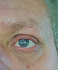 InstaNatural Hyaluronic Acid Face Serum, Brightens, Hydrates, Reduces the Look of Fine Lines and Wrinkles, with Vitamin C, Jojoba Oil, and Aloe Vera, 2 Fl Oz Hyaluronic Acid Serum 32 51gLcOgTVnL