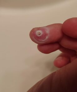 Compound W Wart Remover Maximum Strength One Step Pads, 14 Medicated Pads 14 Count (Pack of 1) 63 51gt0lRQGnL