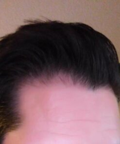 Men's Rogaine 5% Minoxidil Foam for Hair Loss and Hair Regrowth, Topical Treatment for Thinning Hair, 3-Month Supply, 2.11 Ounce (Pack of 3) Men's Rogaine Foam Treatment (3-Month Supply) 2.11 Ounce (Pack of 3) 44 51jZjZG9LL