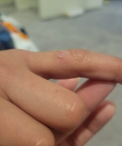 Compound W One Step Wart Remover Strips for Kids, 10 Medicated Strips for Wart Removal, 2 Pack unflavored 10 Count (Pack of 2) 45 51k2cOLRXVL