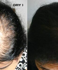 Newopure: Natural Hair Growth Vitamins, Repairs Hair Follicles, Stops Hair Loss, Blocks DHT, Stimulates New Hair Growth, Promotes Thicker, Fuller and Faster Growing Hair. Men & Women (30 Day Supply) 37 51lGjiuY7KL