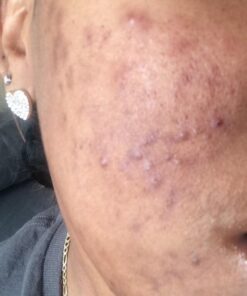 Nubian Heritage African Black Soap, 5 Ounce (Pack of 4) Tea Tree Oil Oats & Aloe 5 Ounce (Pack of 4) 18 51lOw5MGdnL