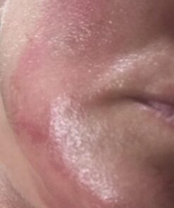 Terrasil Wound Care - 3X Faster Healing, Infection Protection Ointment for bed sores, pressure sores, diabetic wounds, ulcers, cuts, scrapes, and burns (14 gram tube) 37 51lpwAL7YyL