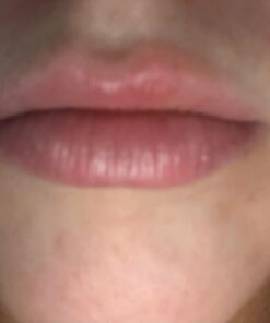 Dr. Dan's Cortibalm - 1 Pack - for Dry Cracked Lips - Healing Lip Balm for Severely Chapped Lips - Designed for Men, Women and Children 0.14 Ounce (Pack of 1) 28 51lrLAl6vFL