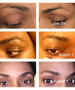 NOW Solutions, Castor Oil, 100% Pure Versatile Skin Care, Multi-Purpose Skin Softener, 16-Ounce 16 Fl Oz (Pack of 1) Standard Packaging 34 51oKH9l FbL