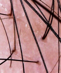 Natrol Biotin Beauty Tablets Promotes Healthy Hair Skin and Nails Helps Support Energy Metabolism Helps Convert Food Into Energy Maximum Strength 10000mcg, Multi, 200 Count 36 51oNpmuP0fL