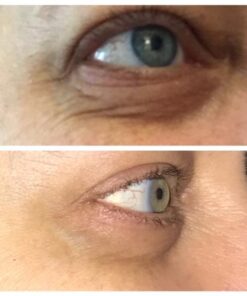 Baebody Eye Gel, Cooling Under Eye Cream For Dark Circles And Puffiness, Eye Cream Anti Aging & Hydrating, Eye Brightening Night Eye Cream 1.7 Fl Oz (Pack of 1) 42 51q6NAlAKLL