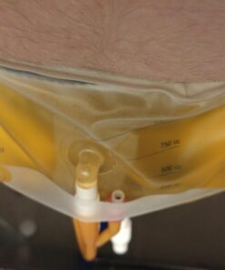 Rusch - Teleflex B1000 Belly Bag Urine Bag, Bellybag Drnbag 1000cc 6 51rs9H8H1PL