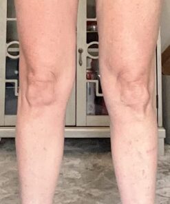 Scala Silicone Anti Cellulite Massager, Body Shower Scrubber, Cellulite Remover - Improve Circulation, Distribute Fat Deposits, Body Massager, Exfoliator, Fat Roller Use with Creams and Oils - Pink A. Pink 24 51s774My hL