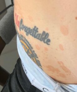 Moisturising Cream, Body and Face Moisturizer for Dry Skin, Acne Cream, 2PC 0.53 Ounce (Pack of 1) 55 51t1bbqgVOL