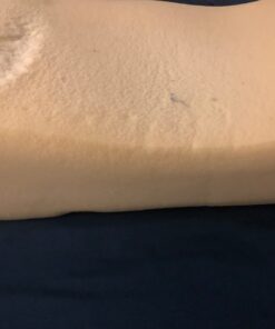 DMI Ortho Bed Wedge Elevated Leg Pillow, Supportive Foam Wedge Pillow for Elevating Legs, Improved Circulataion, Reducing Back Pain, Post Surgery and Injury, Recovery, Blue 8" x 20" x 24" 8 Inch 32 51u4e7GHfvL