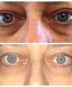 Baebody Eye Gel, Cooling Under Eye Cream For Dark Circles And Puffiness, Eye Cream Anti Aging & Hydrating, Eye Brightening Night Eye Cream 1.7 Fl Oz (Pack of 1) 43 51v67yZkxPL