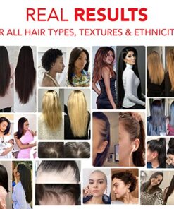 HAIRtamin Vegan Hair Vitamins for Faster Hair Growth | All Natural Biotin Hair Growth Vitamin Capsules to Support Healthy Hair Skin and Nails | May Reduce Hair Loss & Thinning | 30 Capsules 1 24 51vHBVHqK4L 2