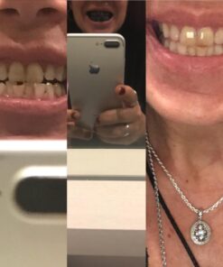 Active Wow Activated Coconut Charcoal Powder - Natural Whitening Activated Charcoal, Charcoal Vanilla Toothpaste, Fluoride Free, Sulfate & Paraben Free, Charcoal Toothpaste Powder (All Natural) All Natural 55 61 1HvqPJoL