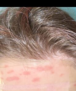 Terrasil Wound Care - 3X Faster Healing, Infection Protection Ointment for bed sores, pressure sores, diabetic wounds, ulcers, cuts, scrapes, and burns (14 gram tube) 32 61 fV2BNTIL