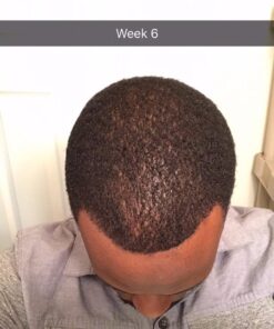 artnaturals Argan Hair Growth Shampoo - (16 Fl Oz / 473ml) - Sulfate Free - Treatment for Hair Loss, Thinning & Regrowth - Men & Women - Infused with Biotin, Argan Oil, Keratin, Caffeine 31 610KUhRb4xL