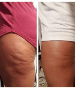 Anti Cellulite Massage Oil Infused with Collagen & Stem Cell Instant Toning Firming of Cellulite & Scar Remover for Thighs & Body Relaxing Sore Muscle Massage Therapy Cream by M3 Naturals 8 Fl Oz (Pack of 1) 39 610LkdDdg2L