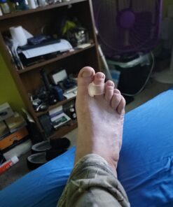 Toe Spacers for Men and Women – 4 Gel Toe Separators, Hammer Toe Straightener, Correct Toes, by 5 Stars United Big 4 Pack 34 610Oimfmw7L