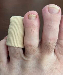 emuaid EMUAIDMAX Ointment 2oz - Eczema Cream. Maximum Strength Treatment. Use Max Strength for Athletes Foot, Psoriasis, Jock Itch, Anti Itch, Rash and Skin Yeast Infection. Standard Packaging 33 610ecwVRD7L