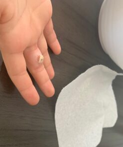 Compound W One Step Wart Remover Strips for Kids, 10 Medicated Strips for Wart Removal, 2 Pack unflavored 10 Count (Pack of 2) 46 610jdA52jBL